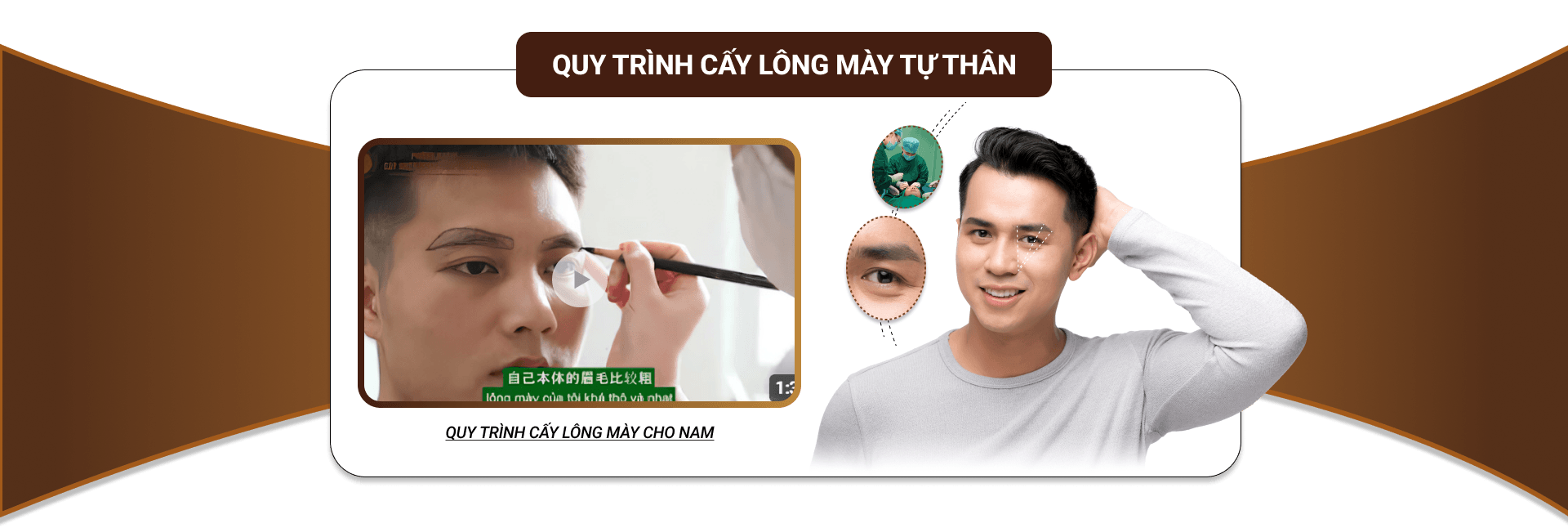 cấy lông mày