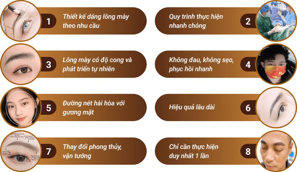 cấy lông mày