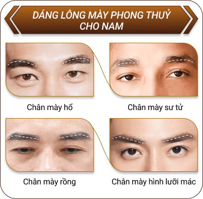 cấy lông mày