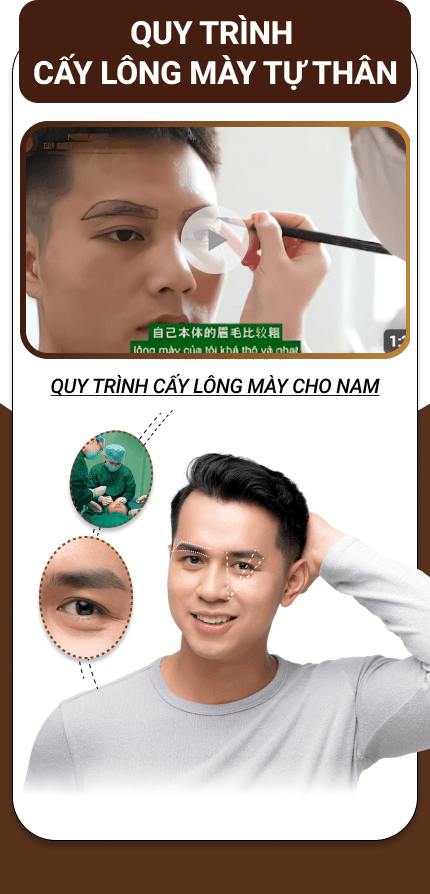 cấy lông mày