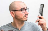 Thuốc chữa rụng tóc cho đàn ông có hiệu quả không?