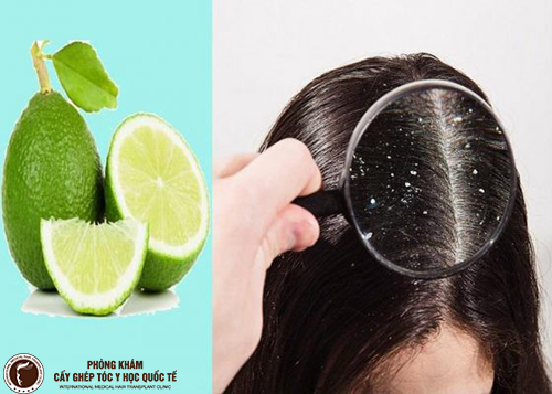 Nguyên nhân gây rụng tóc ở nữ và 5 loại thực phẩm giúp tóc dày mượt