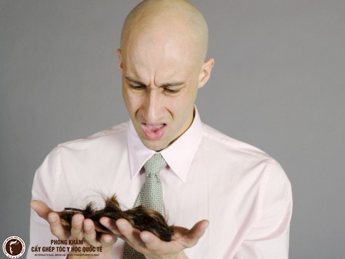 Rụng tóc ở nam giới: nguyên nhân và cách khắc phục