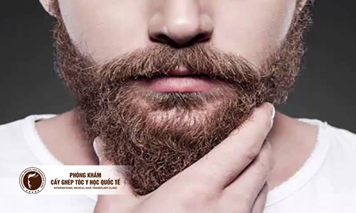Không có râu – Biểu hiện khiến nam giới lo lắng về chuyện sinh lý