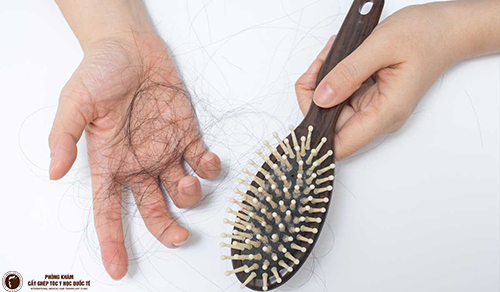 Phân biệt rụng tóc sinh lý và rụng tóc bệnh lý