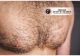Địa chỉ cấy lông ngực an toàn cho nam giới