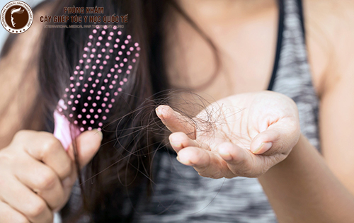 “Cứu tinh” giúp bạn chữa trị rụng tóc hiệu quả?
