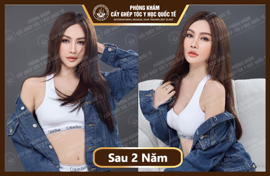 Á Hậu Kim Duyên - Cấy tóc 9