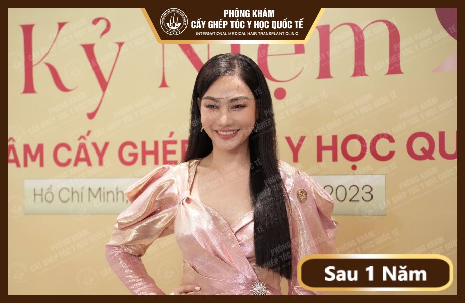 Á Hậu Kim Duyên - Cấy tóc 5